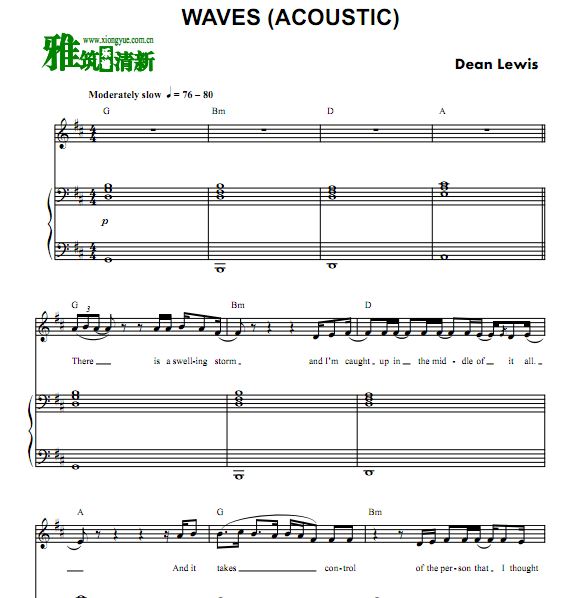 Dean Lewis - Waves (Acoustic)ٰ 